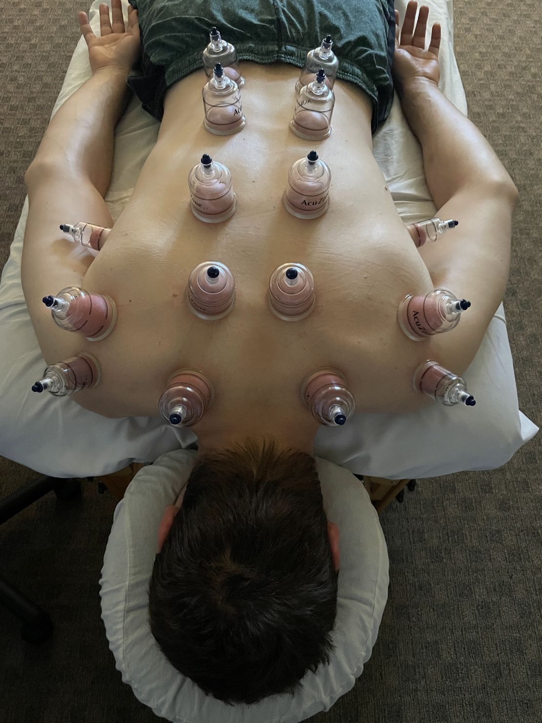 bodywork for pain, medical massage in Fairlawn Ohio