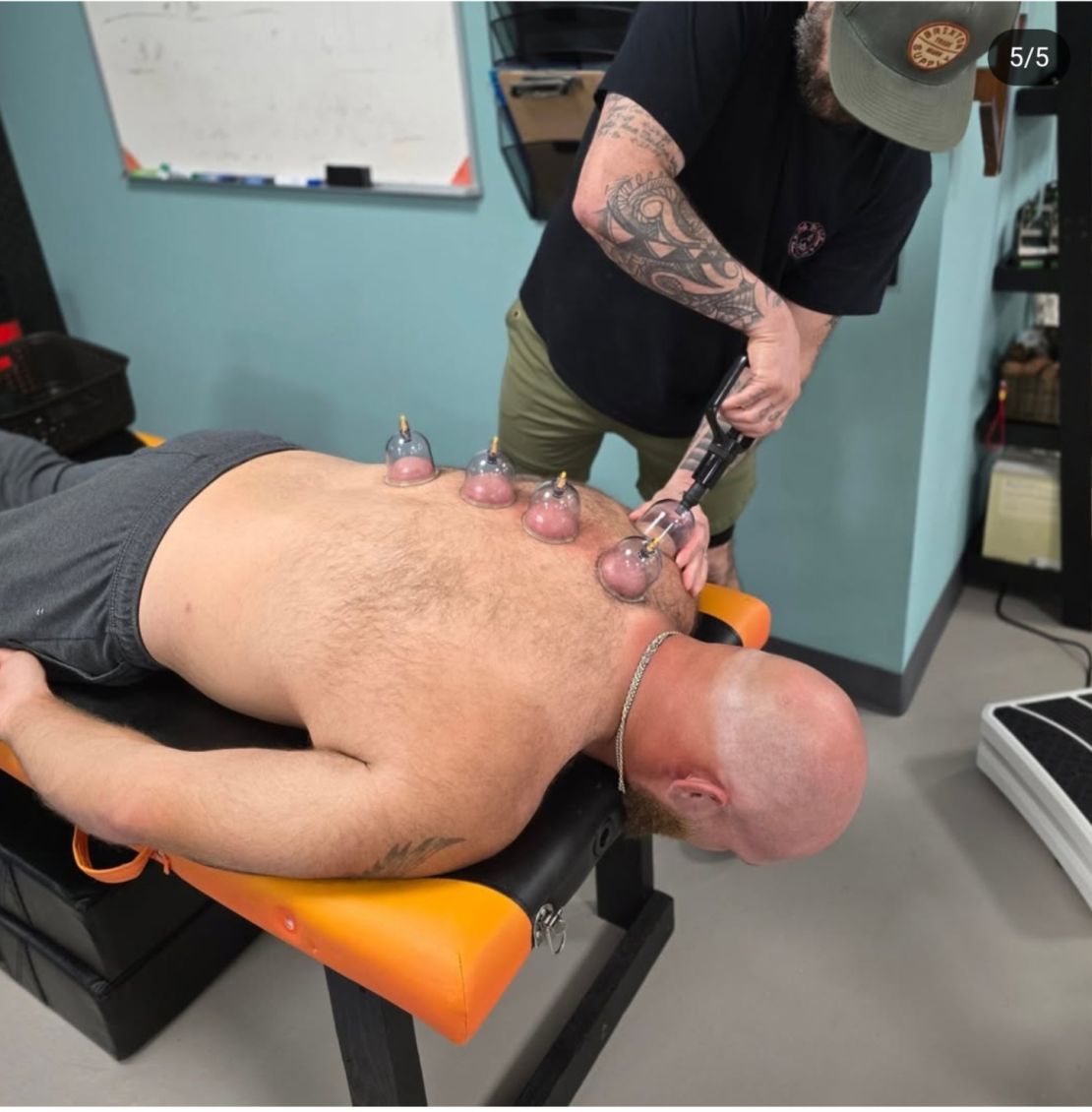 Conrad shown here performiong cupping on an elite athlete at Truly Heal Wellness in Akron, Ohio