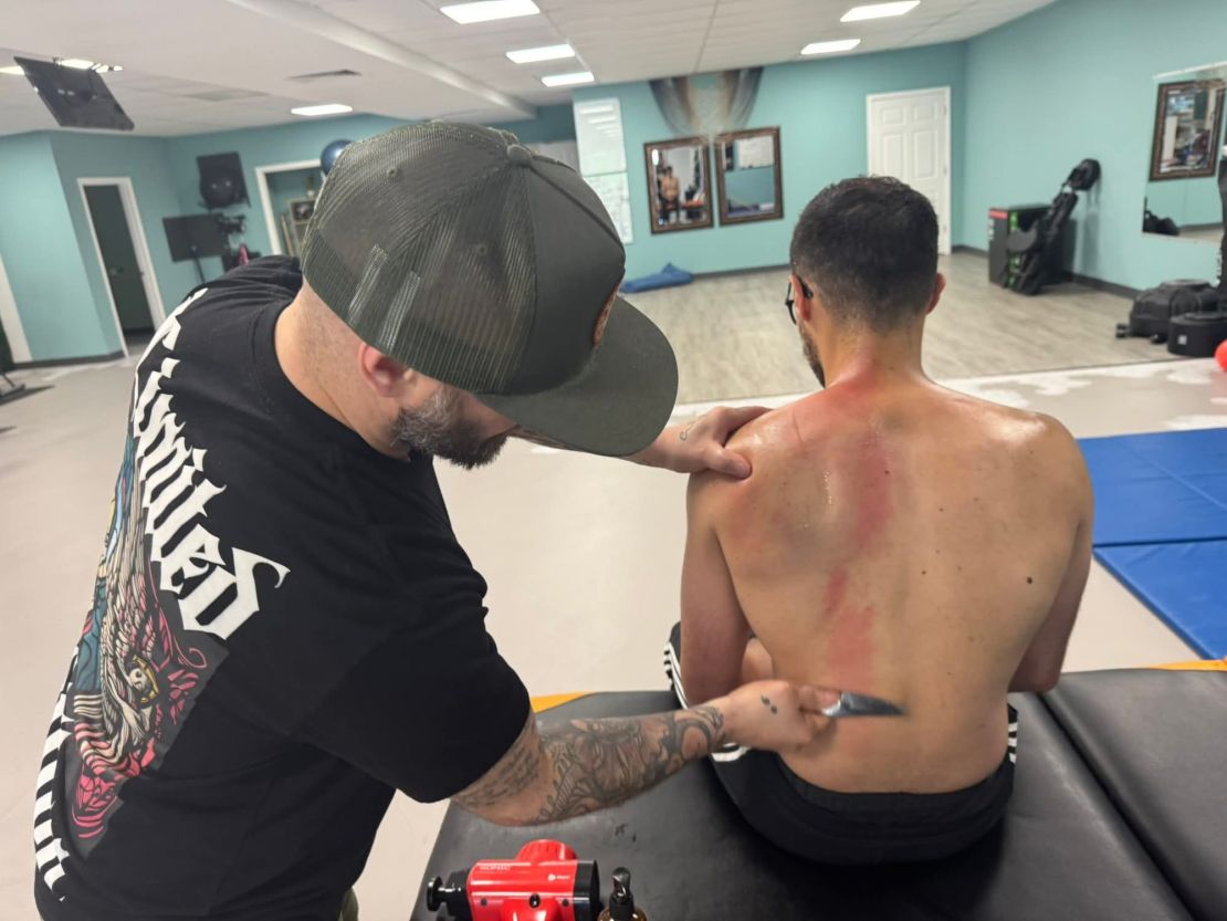 Graston Technique being applied to a male client’s back—practitioner uses metal tool to perform scraping therapy in a wellness setting with gym equipment in the background.